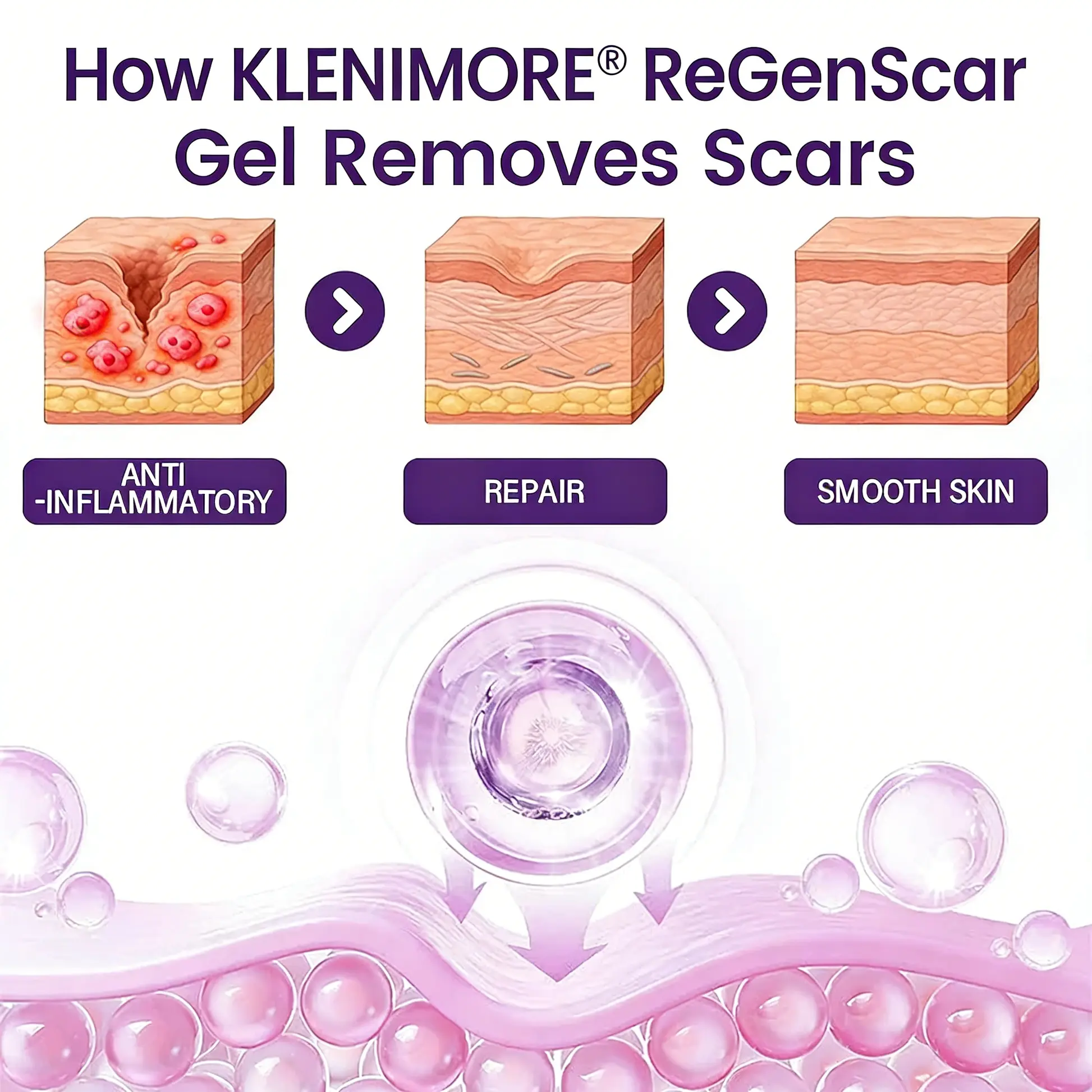 ReGenScar Stem Cell Scar Gel - Image 3