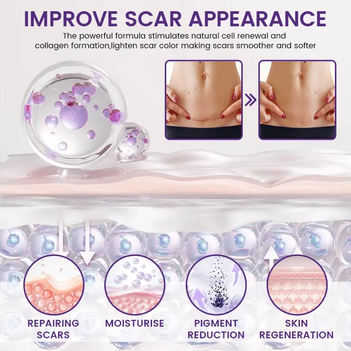 ReGenScar Stem Cell Scar Gel - Image 4