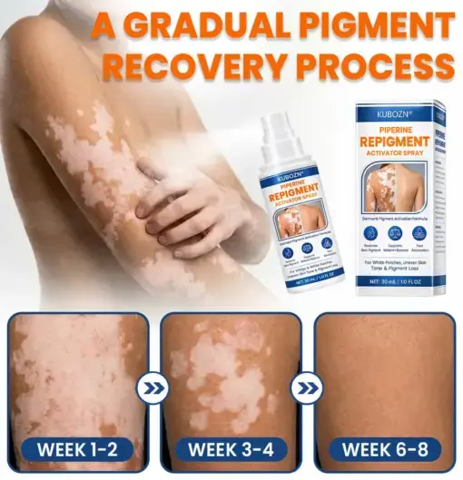 Piperine Repigment Activator Spray to Reactivate Dormant Pigment Cells & Restore Natural Skin Color - Image 4