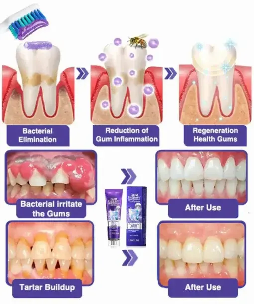 Bee Poison Dental Treatment Toothpaste - Image 6
