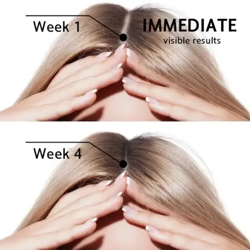 Highly Effective Biotin & Rosemary Hair Growth Serum - Image 7