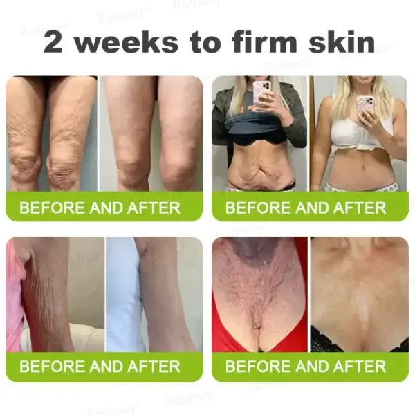 Last Day! 70% OFF 💫 Botox & Vita-A Retinol Wrinkle-Lift Cream – Made & Shipped from CA 🔥 - Image 8