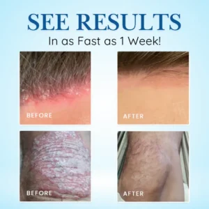 Alternative view of Source-Relief Magnesium Spray