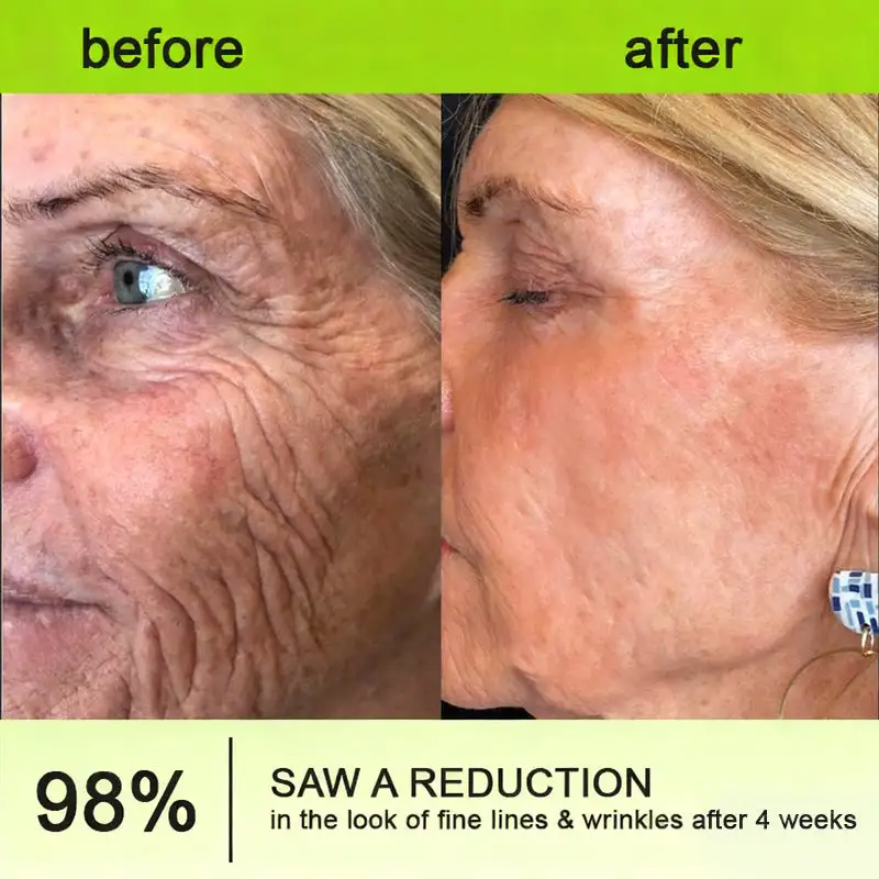 👏🌿Made and shipped from the USA Botox & Vita-A Retinol Shot Wrinkle-Lift Tightening cream - Last Day Promotion 70% OFF - Image 7