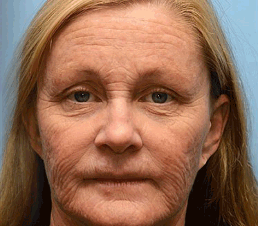 Skin Tightening & Vita-A Retinol Retinol shot Anti-Wrinkle Firming Tightening cream - Image 6