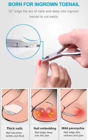 Medical-Grade Nail Clipper - Image 7