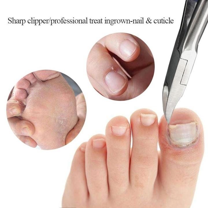 Medical-Grade Nail Clipper - Image 3