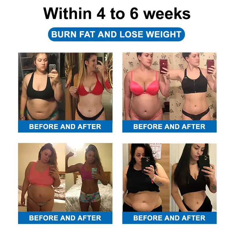 Ultrasonic Fat Blasting and Detoxing Wristband B - Image 3