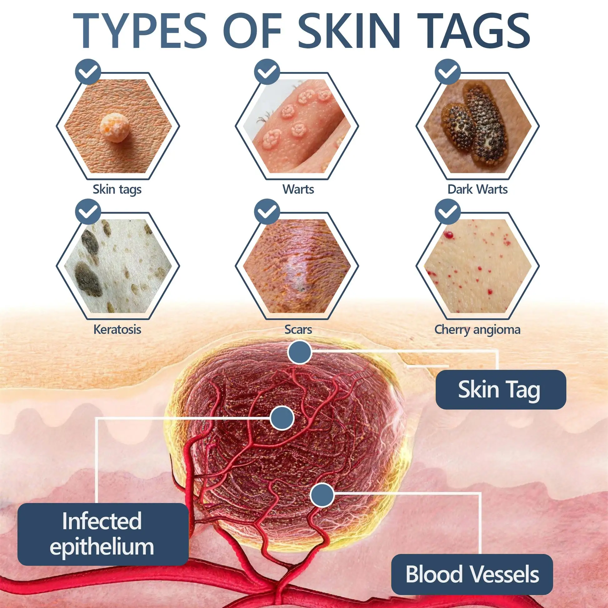 𝑽𝒊𝒕𝒂𝒍𝒊𝒔𝒚𝒔 𝑷𝒂𝒊𝒏𝒍𝒆𝒔𝒔 𝑩𝒊𝒐-𝑪𝒓𝒚𝒐𝒈𝒆𝒏 𝒕𝒆𝒄𝒉𝒏𝒐𝒍𝒐𝒈𝒚 𝑹𝒆𝒎𝒐𝒗𝒂𝒍 𝑾𝒂𝒓𝒕 𝑺𝒑𝒓𝒂𝒚 - Image 2