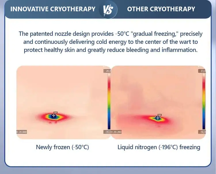 𝑽𝒊𝒕𝒂𝒍𝒊𝒔𝒚𝒔 𝑷𝒂𝒊𝒏𝒍𝒆𝒔𝒔 𝑩𝒊𝒐-𝑪𝒓𝒚𝒐𝒈𝒆𝒏 𝒕𝒆𝒄𝒉𝒏𝒐𝒍𝒐𝒈𝒚 𝑹𝒆𝒎𝒐𝒗𝒂𝒍 𝑾𝒂𝒓𝒕 𝑺𝒑𝒓𝒂𝒚 - Image 5