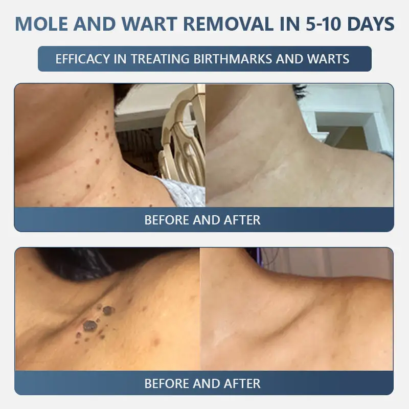 𝑽𝒊𝒕𝒂𝒍𝒊𝒔𝒚𝒔 𝑷𝒂𝒊𝒏𝒍𝒆𝒔𝒔 𝑩𝒊𝒐-𝑪𝒓𝒚𝒐𝒈𝒆𝒏 𝒕𝒆𝒄𝒉𝒏𝒐𝒍𝒐𝒈𝒚 𝑹𝒆𝒎𝒐𝒗𝒂𝒍 𝑾𝒂𝒓𝒕 𝑺𝒑𝒓𝒂𝒚 - Image 6