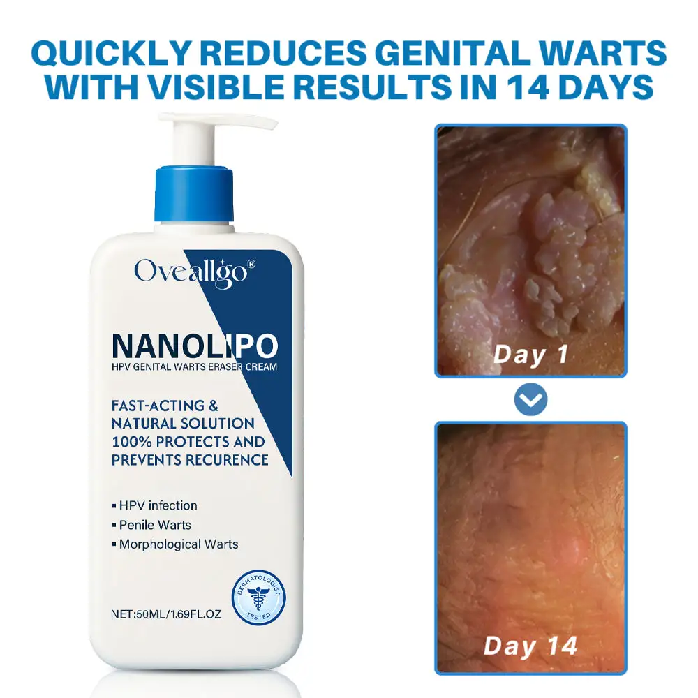 NanoLipo HPV Genital Warts Eraser Cream ProX - Image 2