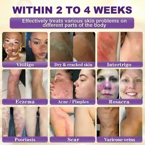 Proprietary Biotin Blend Skin Restoration Cream - Image 2