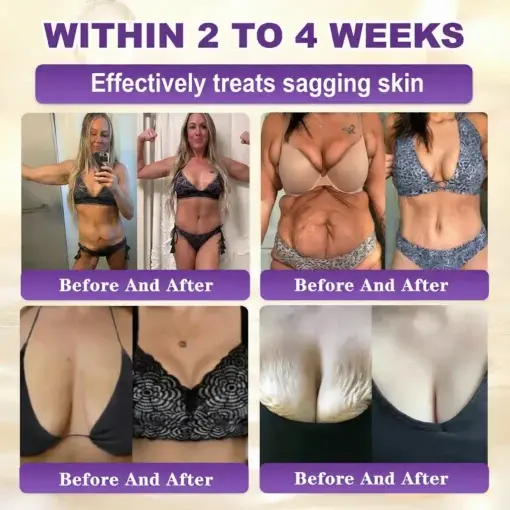 Proprietary Biotin Blend Skin Restoration Cream - Image 3