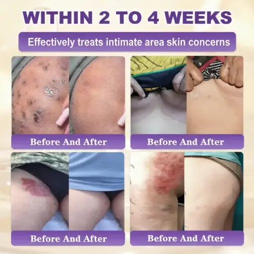 Proprietary Biotin Blend Skin Restoration Cream - Image 4