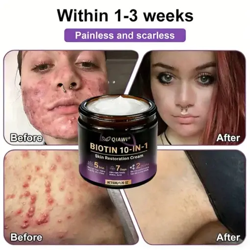 Proprietary Biotin Blend Skin Restoration Cream - Image 6