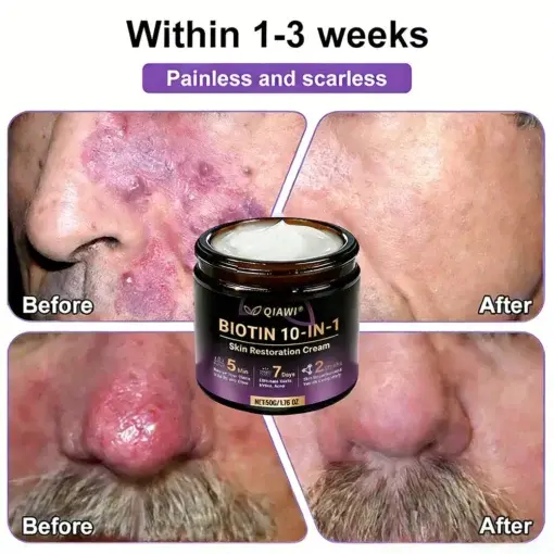 Proprietary Biotin Blend Skin Restoration Cream - Image 8