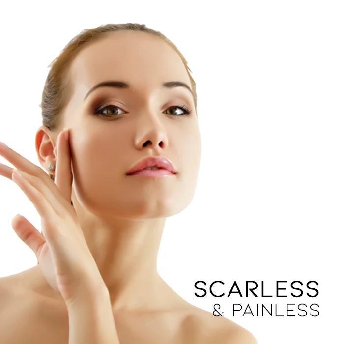 SkinChemist Eye Milia Removal Cream - Image 2