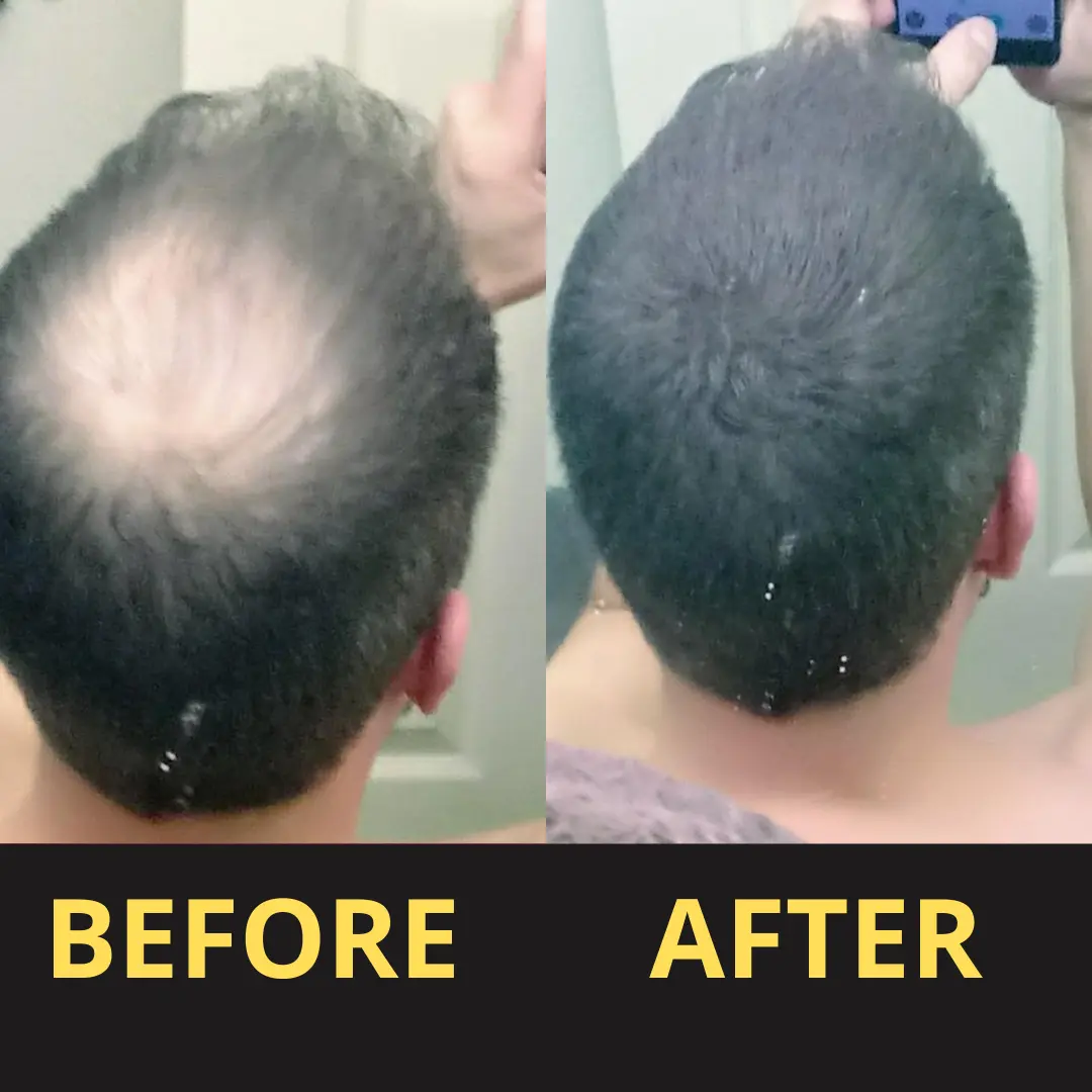 Yagoo Hair Concealer 50ML - Waterproof 3–7 days. - Image 10