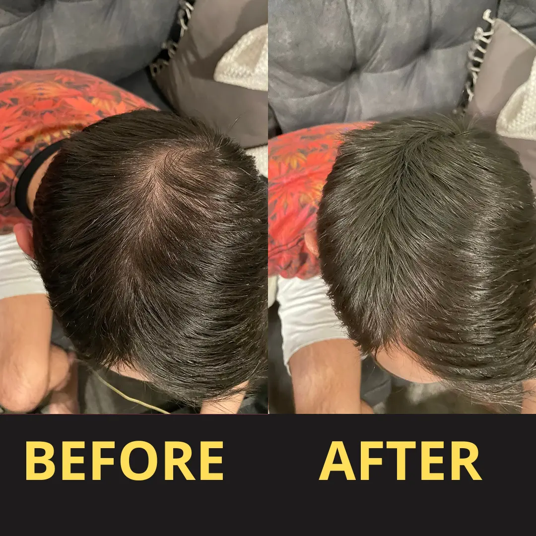 Yagoo Hair Concealer 50ML - Waterproof 3–7 days. - Image 11