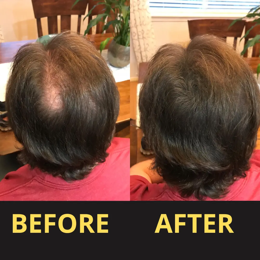 Yagoo Hair Concealer 50ML - Waterproof 3–7 days. - Image 12