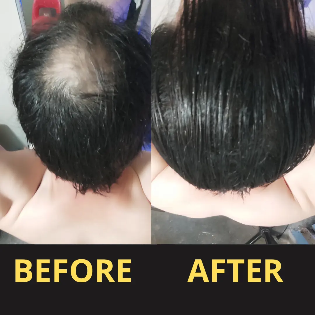 Yagoo Hair Concealer 50ML - Waterproof 3–7 days. - Image 13