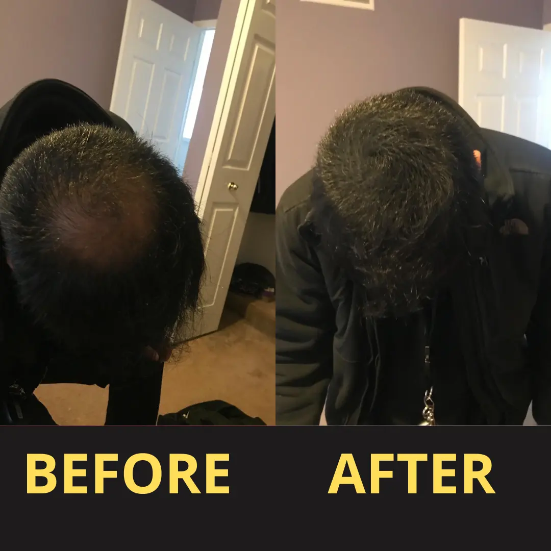 Yagoo Hair Concealer 50ML - Waterproof 3–7 days. - Image 15