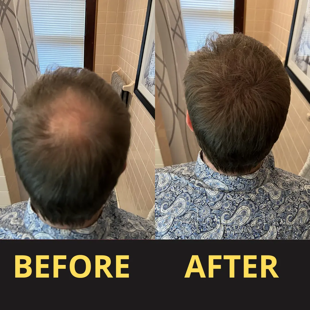 Yagoo Hair Concealer 50ML - Waterproof 3–7 days. - Image 16