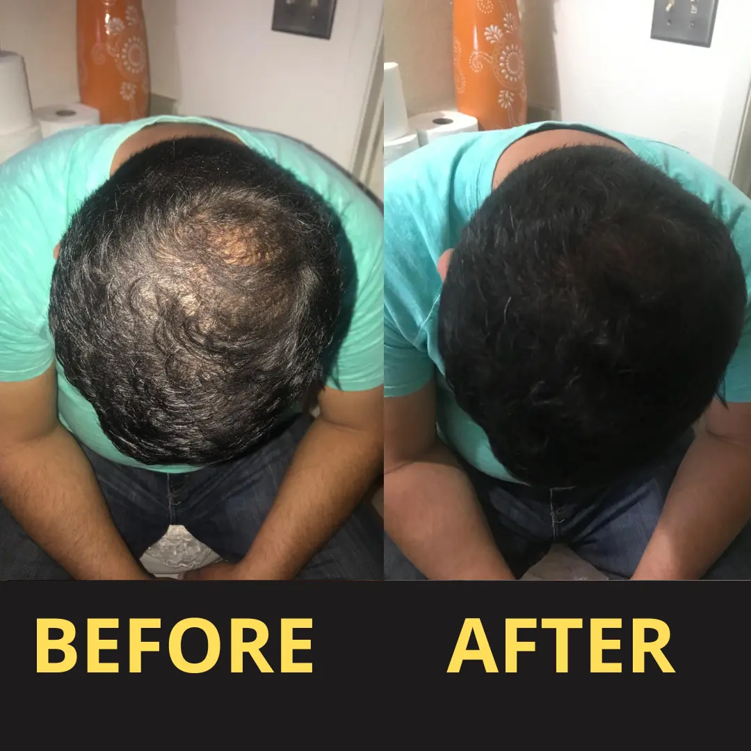 Yagoo Hair Concealer 50ML - Waterproof 3–7 days. - Image 17