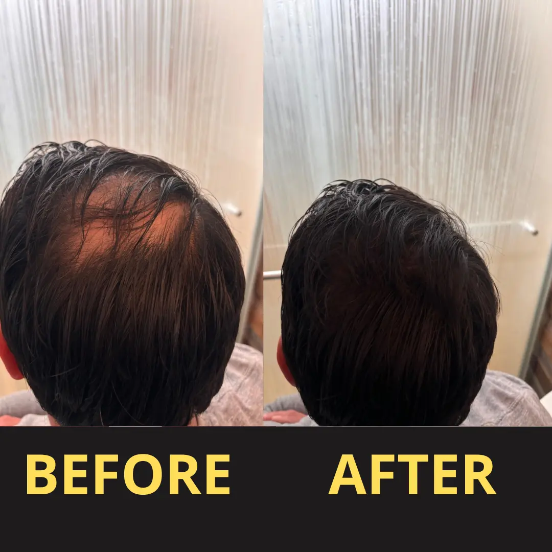 Yagoo Hair Concealer 50ML - Waterproof 3–7 days. - Image 18