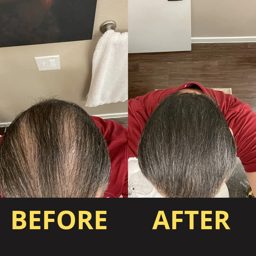 Yagoo Hair Concealer 50ML - Waterproof 3–7 days. - Image 4