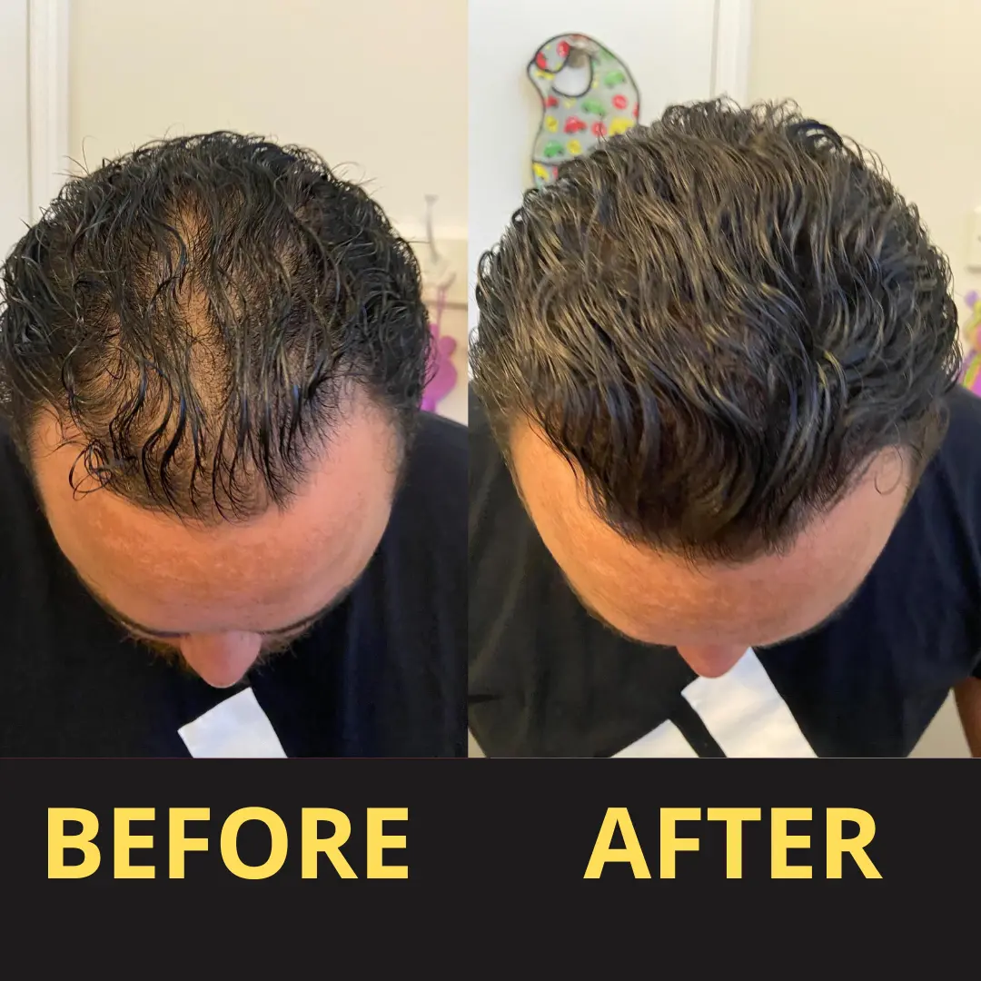 Yagoo Hair Concealer 50ML - Waterproof 3–7 days. - Image 5