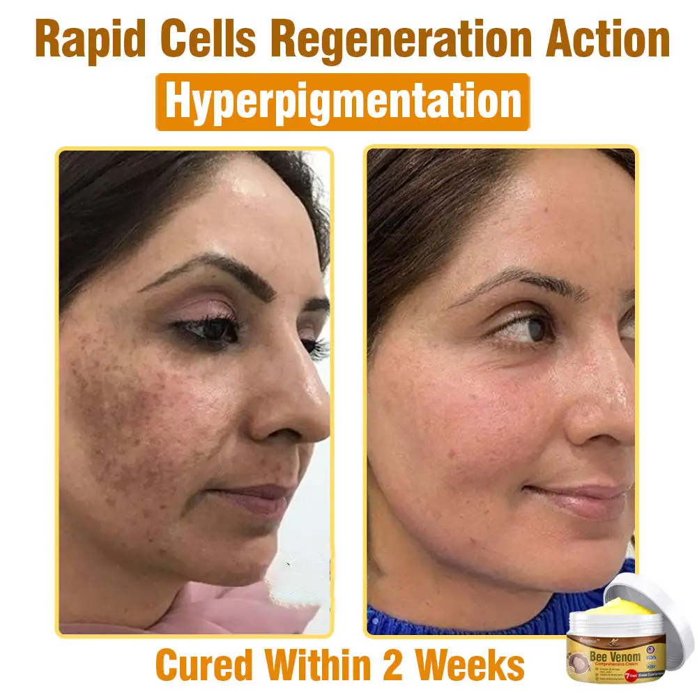 Bee Venom Comprehensive Skin Treatment Cream - Image 10