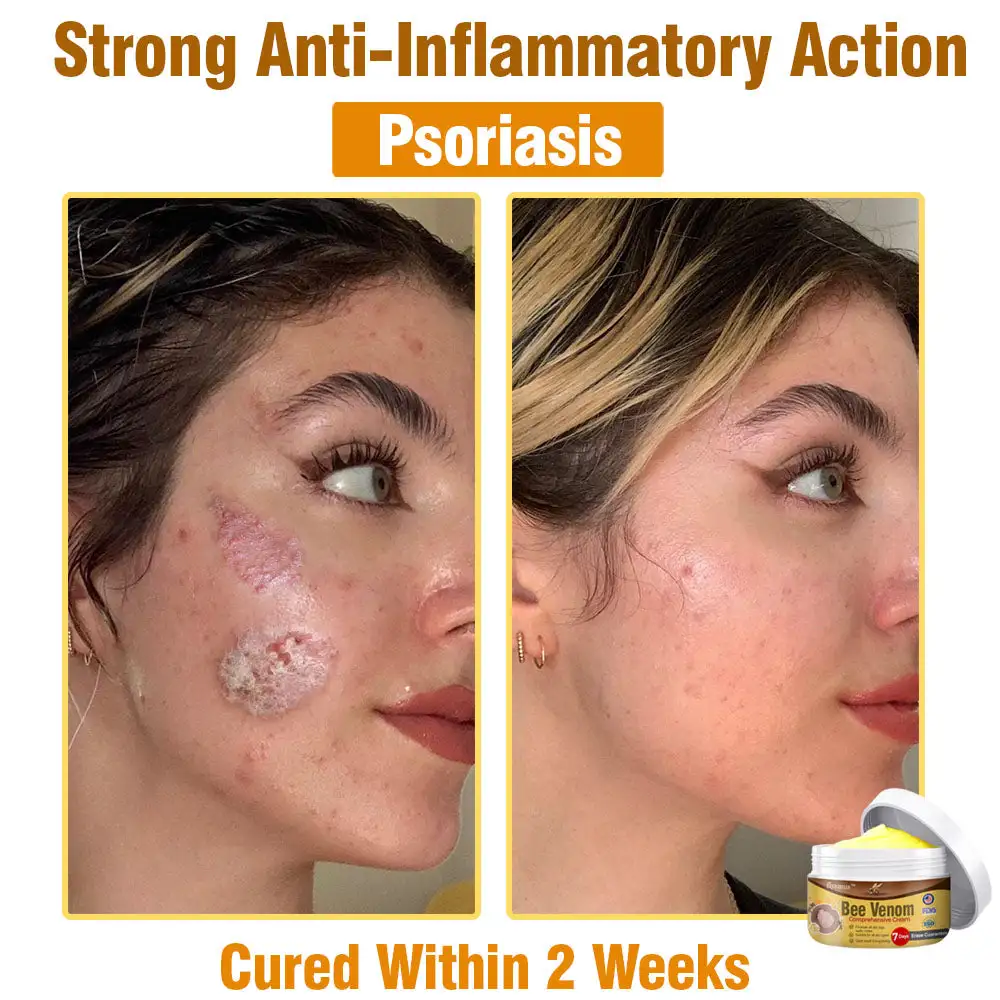 Bee Venom Comprehensive Skin Treatment Cream - Image 3