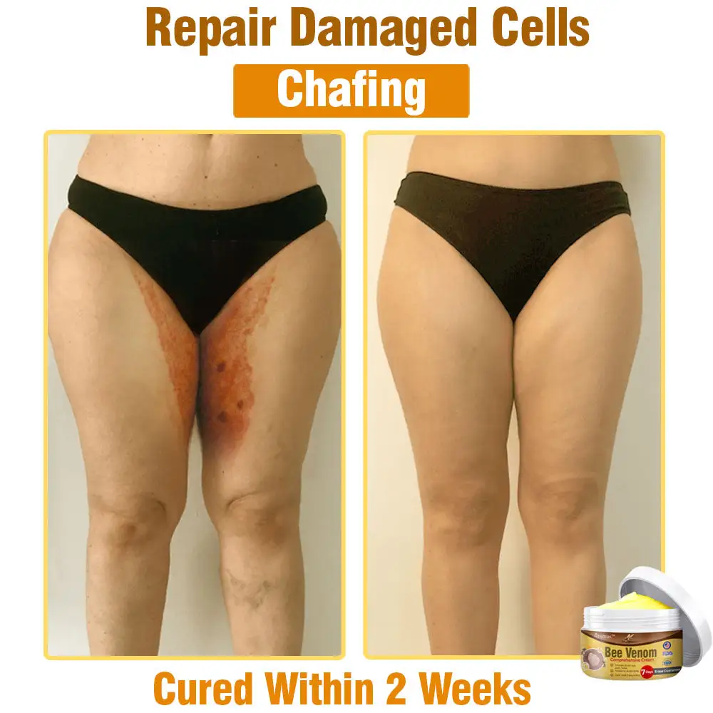 Bee Venom Comprehensive Skin Treatment Cream - Image 4