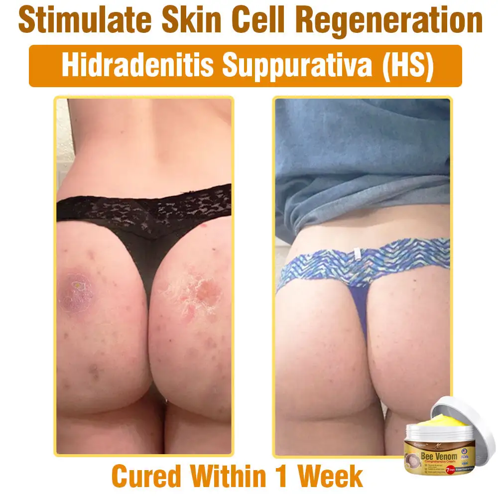 Bee Venom Comprehensive Skin Treatment Cream - Image 6