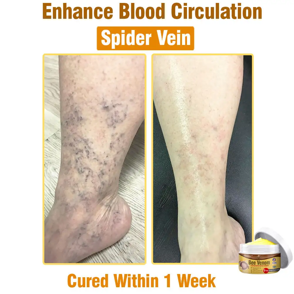 Bee Venom Comprehensive Skin Treatment Cream - Image 7