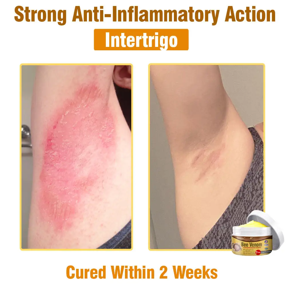 Bee Venom Comprehensive Skin Treatment Cream - Image 8