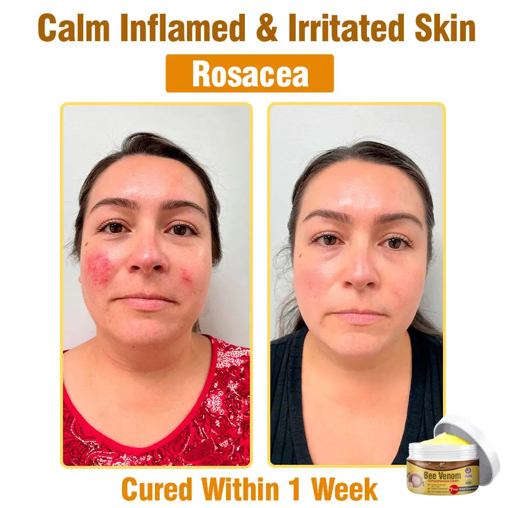 Bee Venom Comprehensive Skin Treatment Cream - Image 9