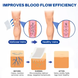 Alternative view of Vein Contour Micro-Patches: The 7-Day Transformation for Varicose Veins