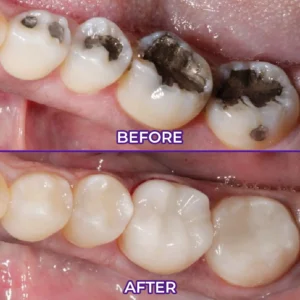 Alternative view of VioletX Advanced Whitening Complex