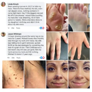 Alternative view of Timilk Bump Renewal Spray