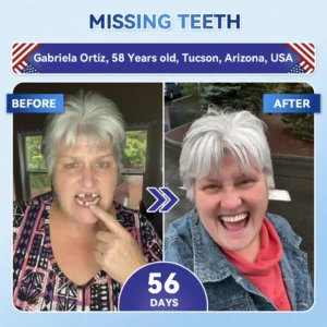Alternative view of Tideglusib Fast‑Dissolving Tooth & Gum Repair Oral Strips