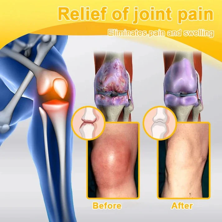 Botulinum Toxin & Bee Venom Pain-Relief Bone Healing Cream - Image 15