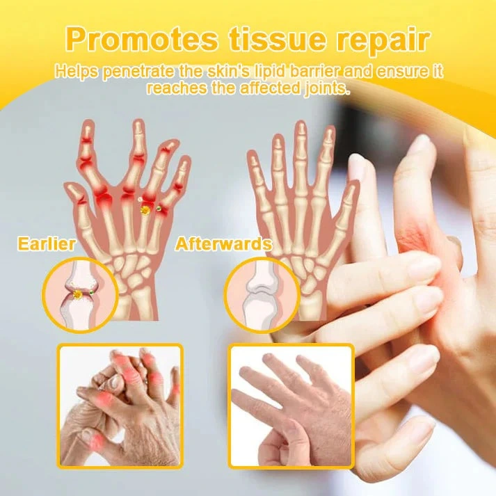 Botulinum Toxin & Bee Venom Pain-Relief Bone Healing Cream - Image 16