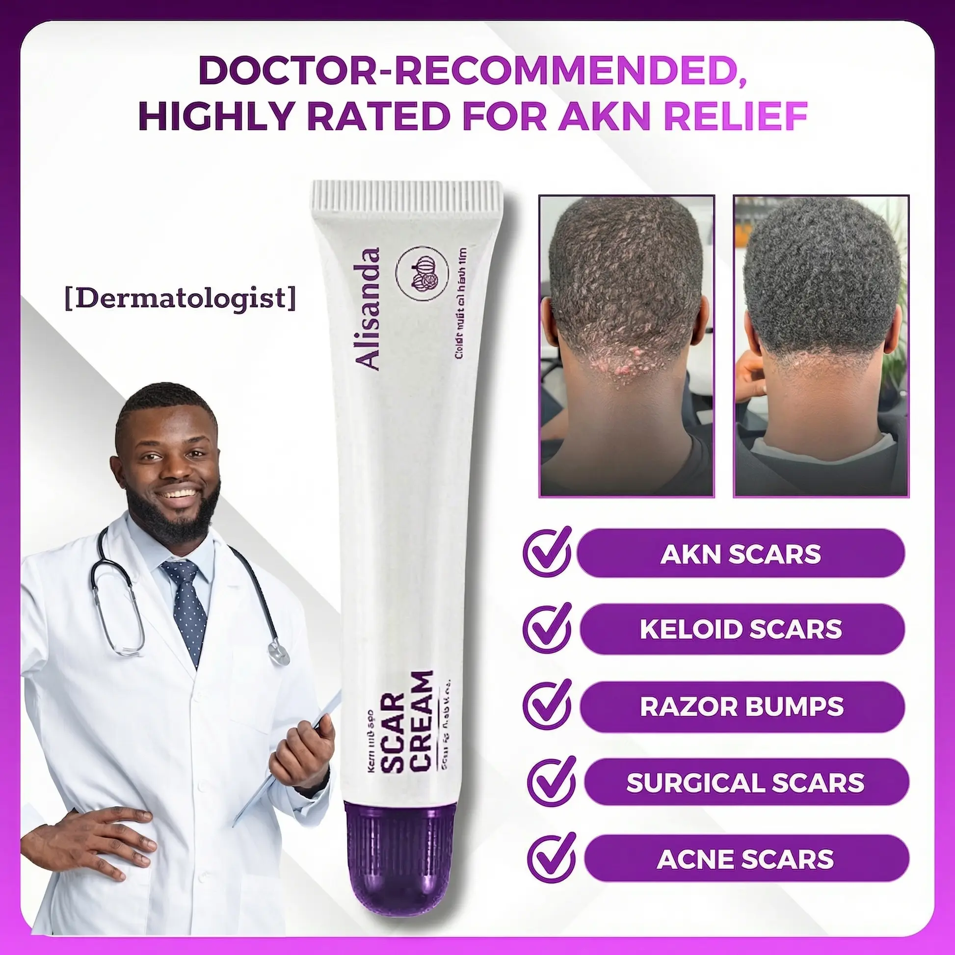 Alisanda Scar Cream – Advanced Treatment for Raised & Keloid Scars