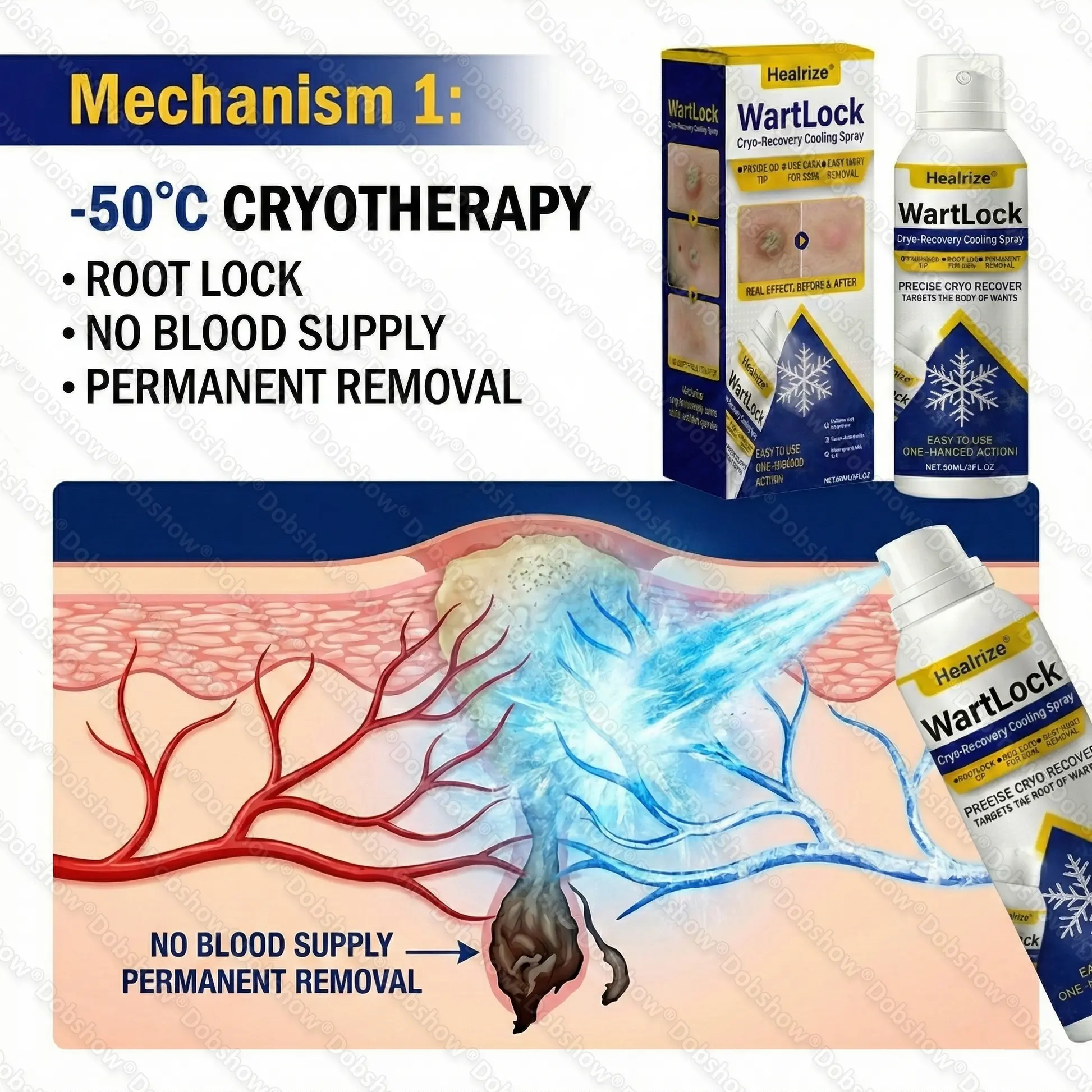 Wart Lock Cryo-Recovery Cooling Spray - Image 2