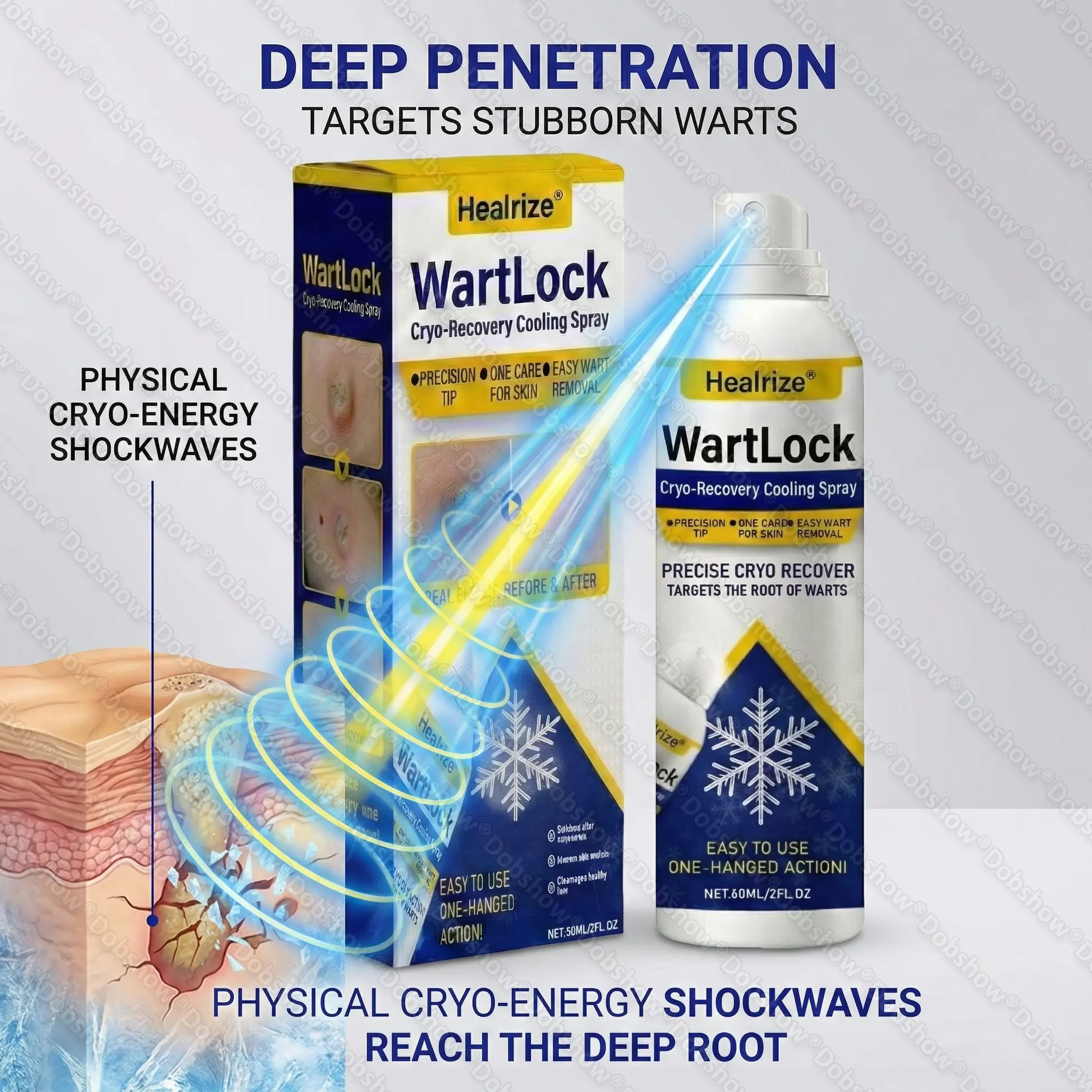 Wart Lock Cryo-Recovery Cooling Spray - Image 5