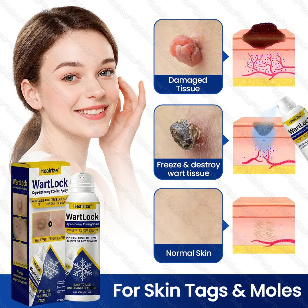 Wart Lock Cryo-Recovery Cooling Spray - Image 6
