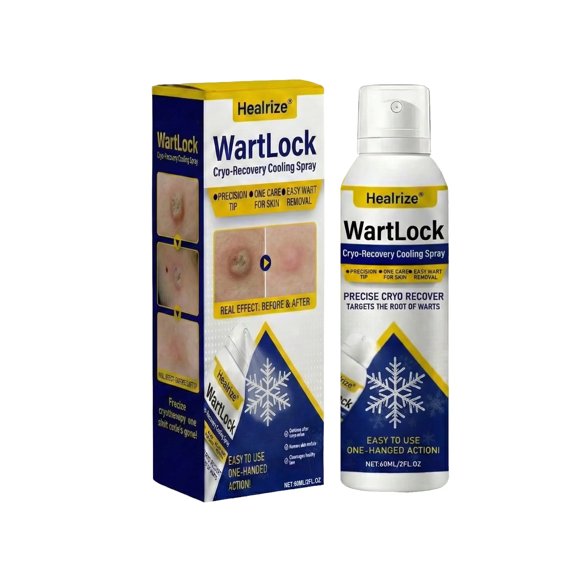 Wart Lock Cryo-Recovery Cooling Spray - Image 8